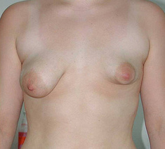 tubulaire-borsten1-voor